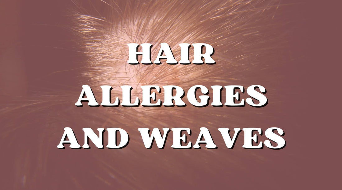 Hair Allergies Preventing You from Wearing Quick Weaves and Sew-Ins