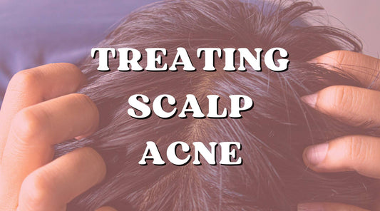 Scalp Acne: How to Treat and Soothe It Off?